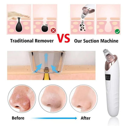 Face Vacuum Suction Blackhead Remover Pore Cleaner Electric Deep Cleansing Tool For Nose And Face